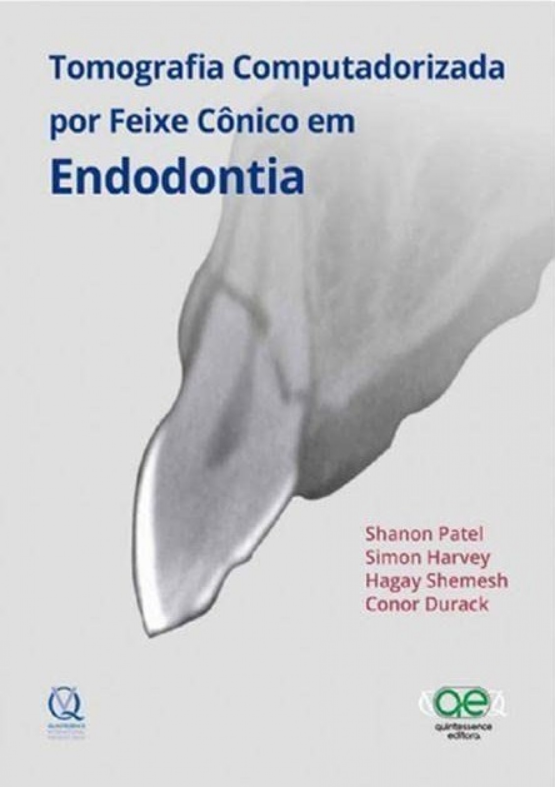 Tomografia Computadorizada Por Feixe Cônico Em Endodontia
