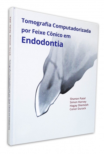 Tomografia Computadorizada Por Feixe Cônico Em Endodontia