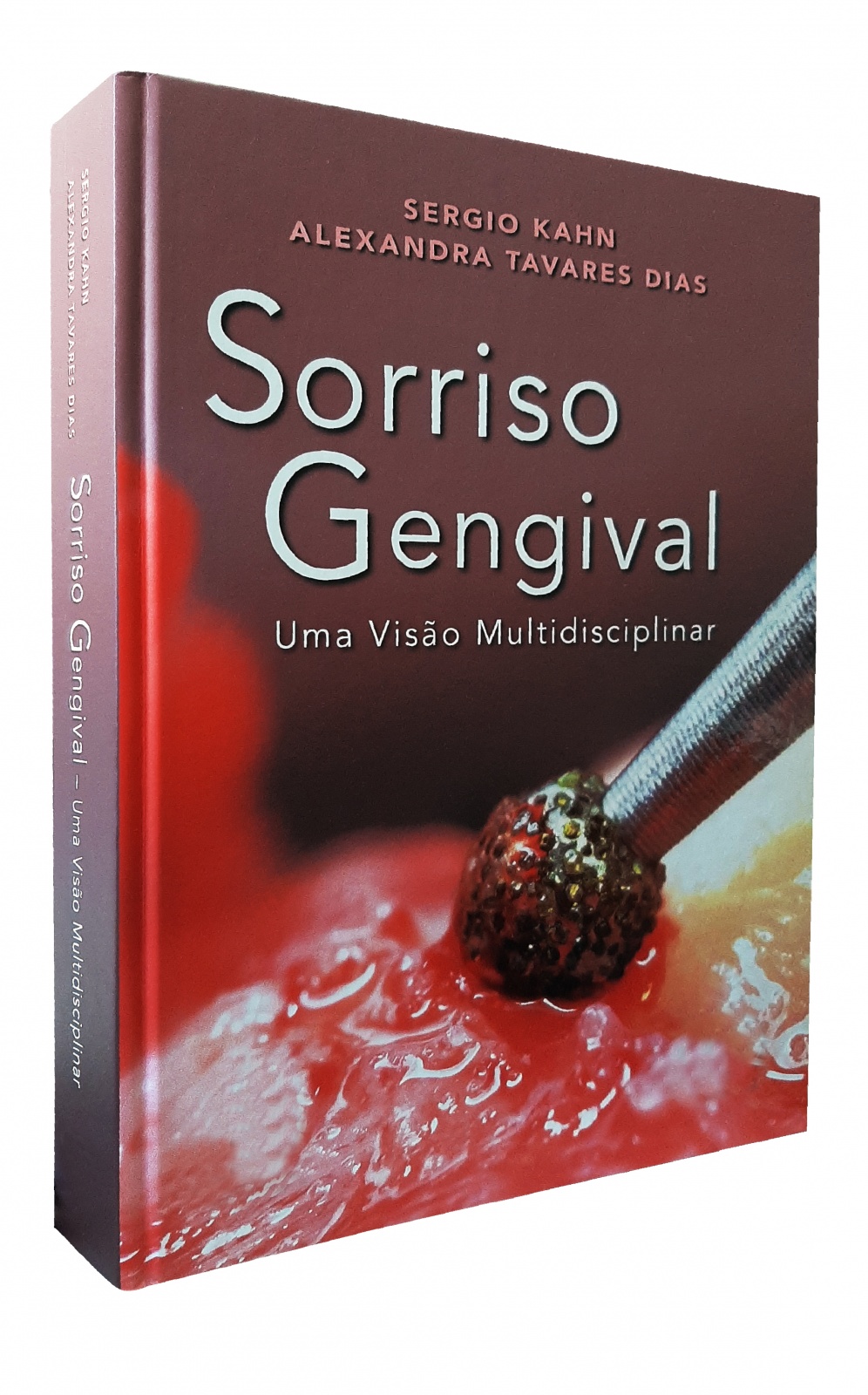 Sorriso Gengival • Uma Visão Multidiciplinar