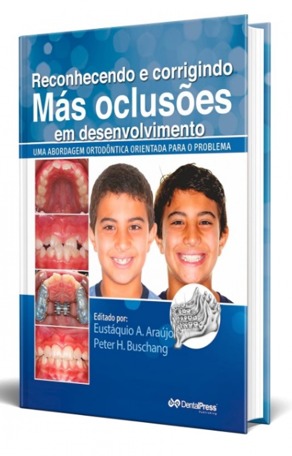 Reconhecendo E Corrigindo Más Oclusões Em Desenvolvimento