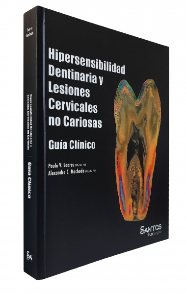 Hipersensibilidad Dentinaria Y Lesiones Cervicales No Cariosas – Guía Clínico