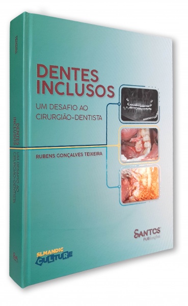 Dentes Inclusos - Um Desafio Ao Cirurgião Dentista