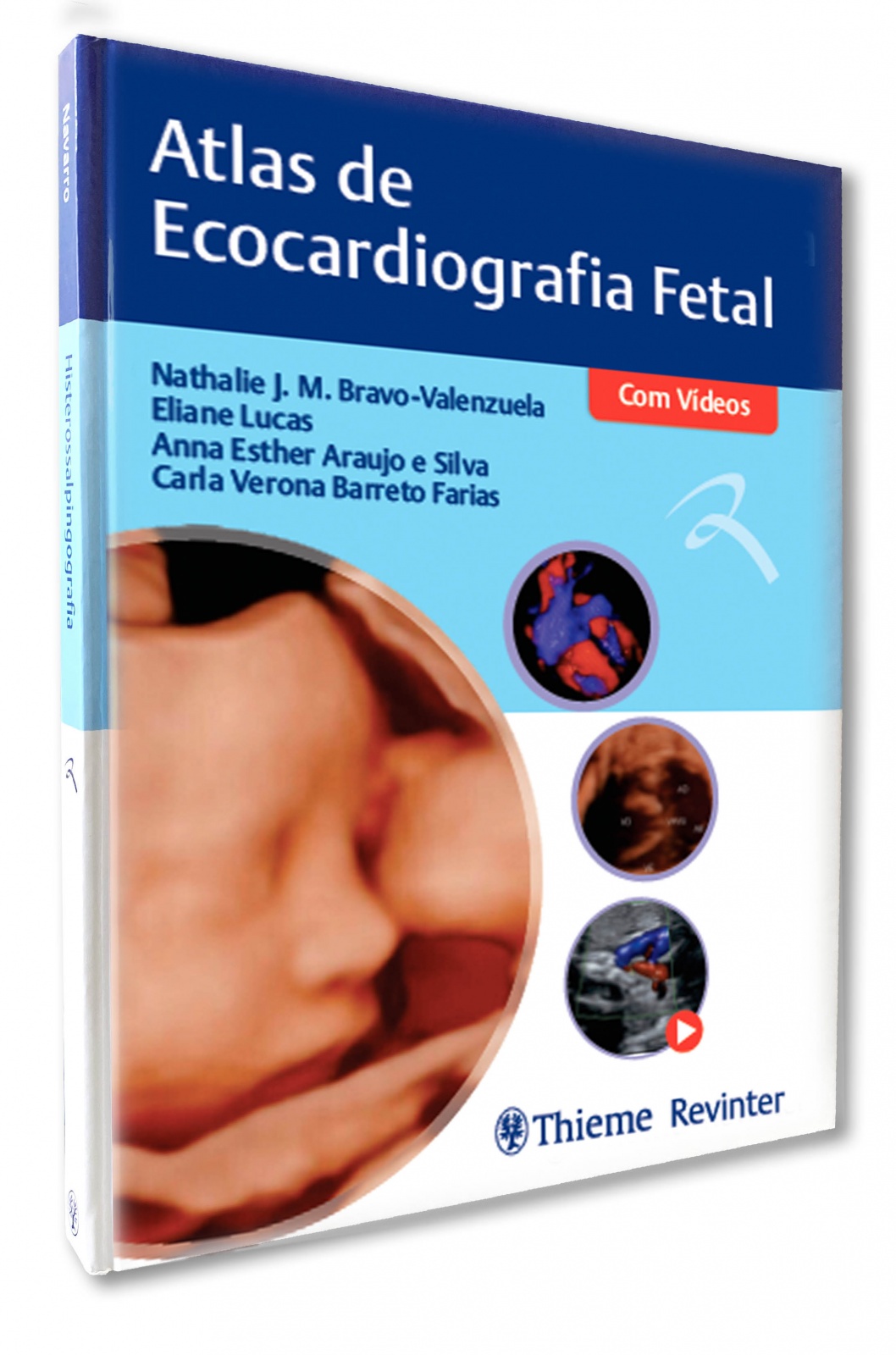 Atlas De Ecocardiografia Fetal