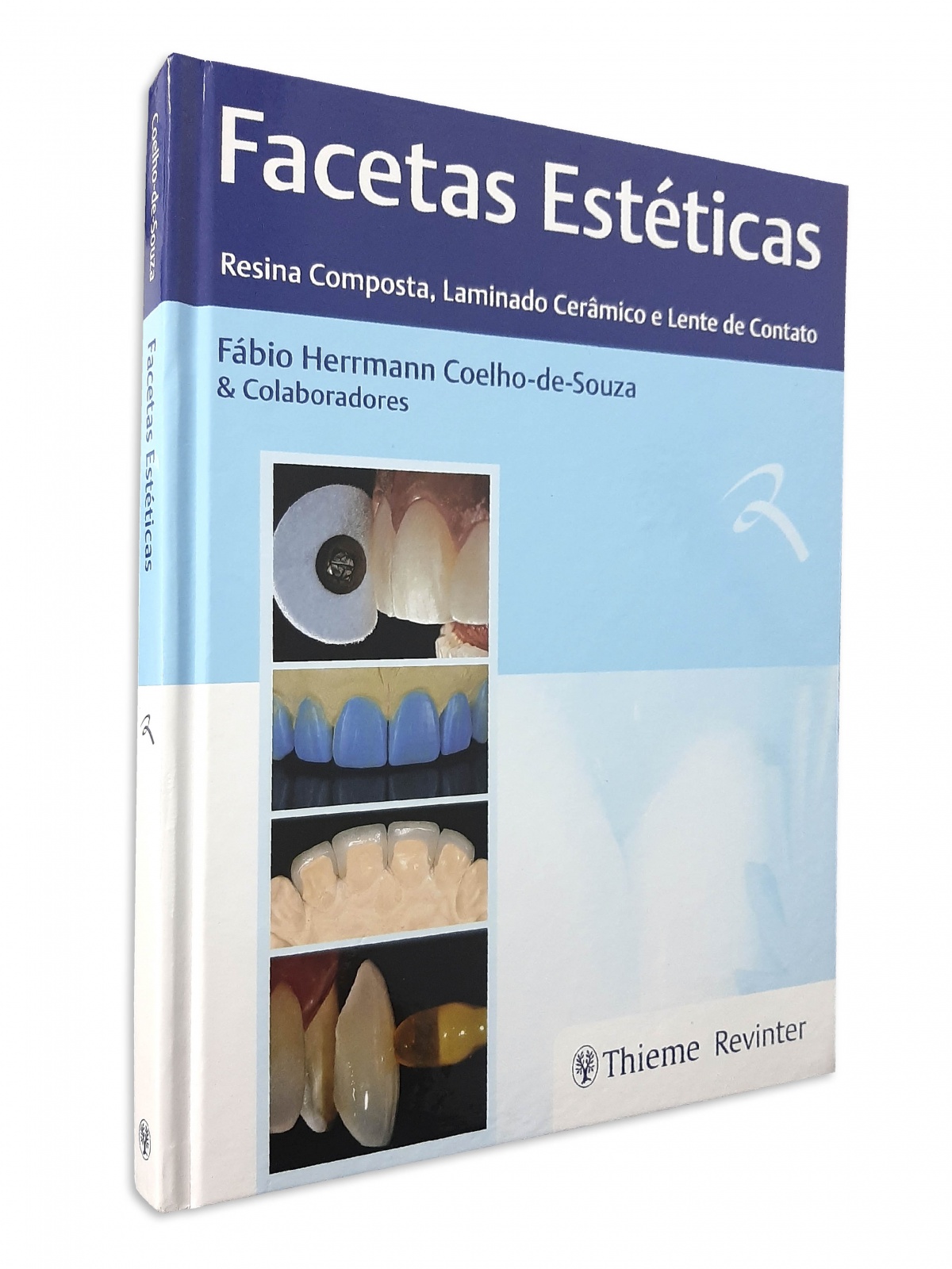 Facetas Estéticas - Resina Composta, Laminado Cerâmico E Lente De Contato