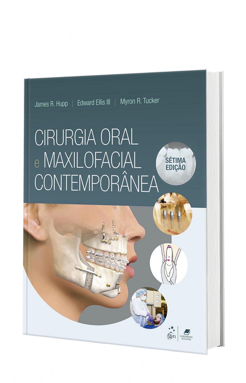 Cirurgia Oral E Maxilofacial Contemporânea