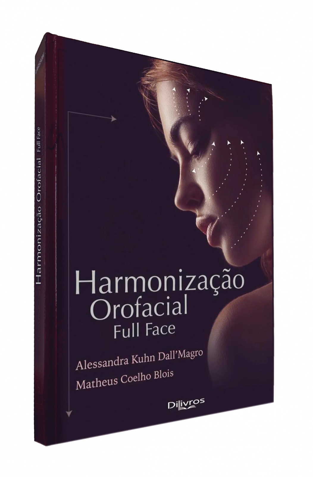 Harmonizacao Orofacial Full Face
