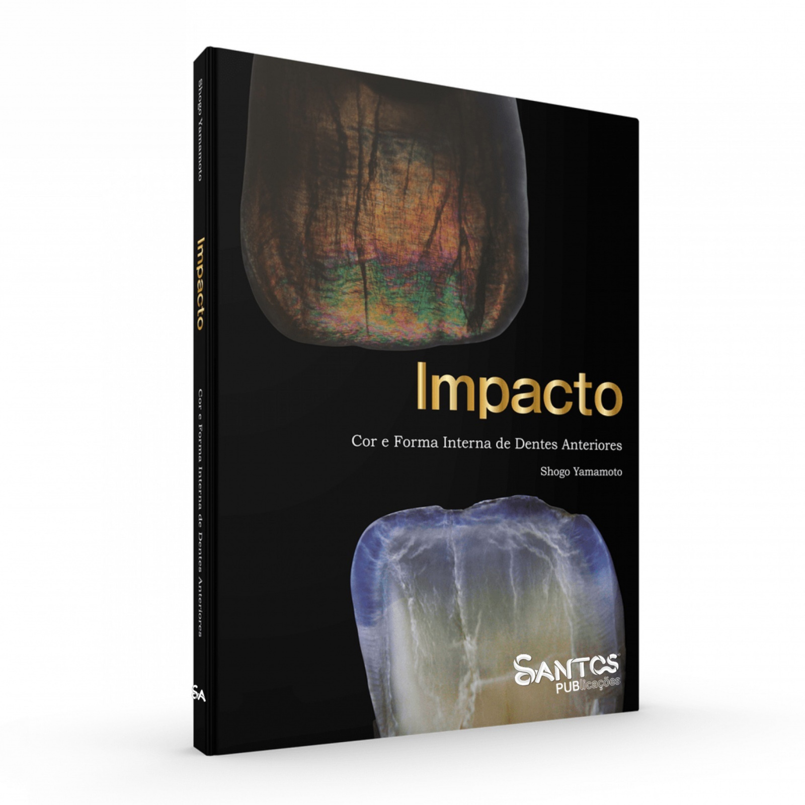 Impacto • Cor E Forma Interna De Dentes Anteriores (Edição Bilingue)