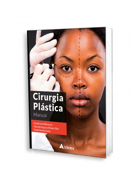 Cirurgia Plástica - Manual