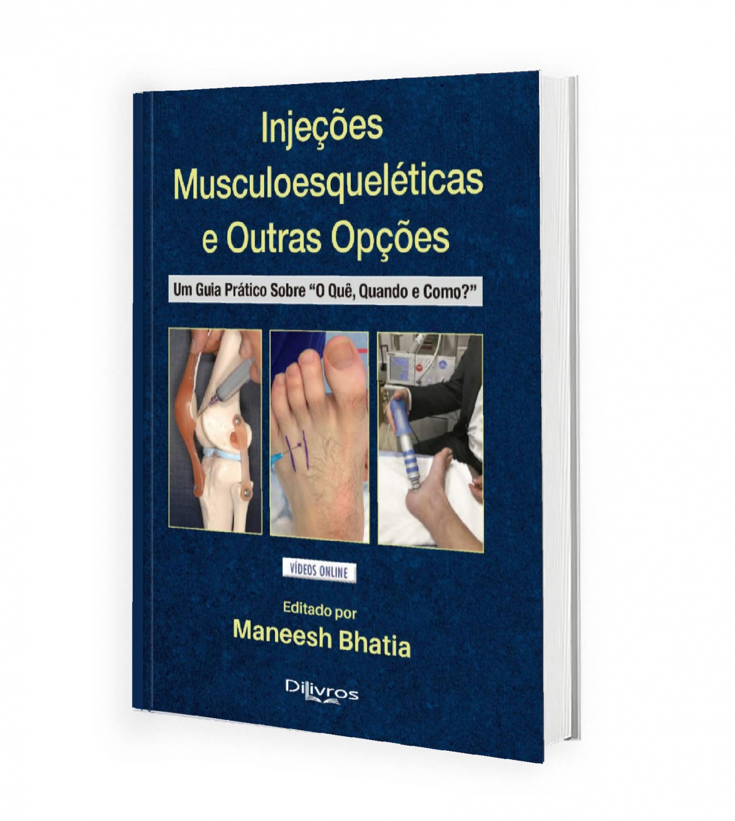 Injeções Musculoesqueléticas E Outras Opções