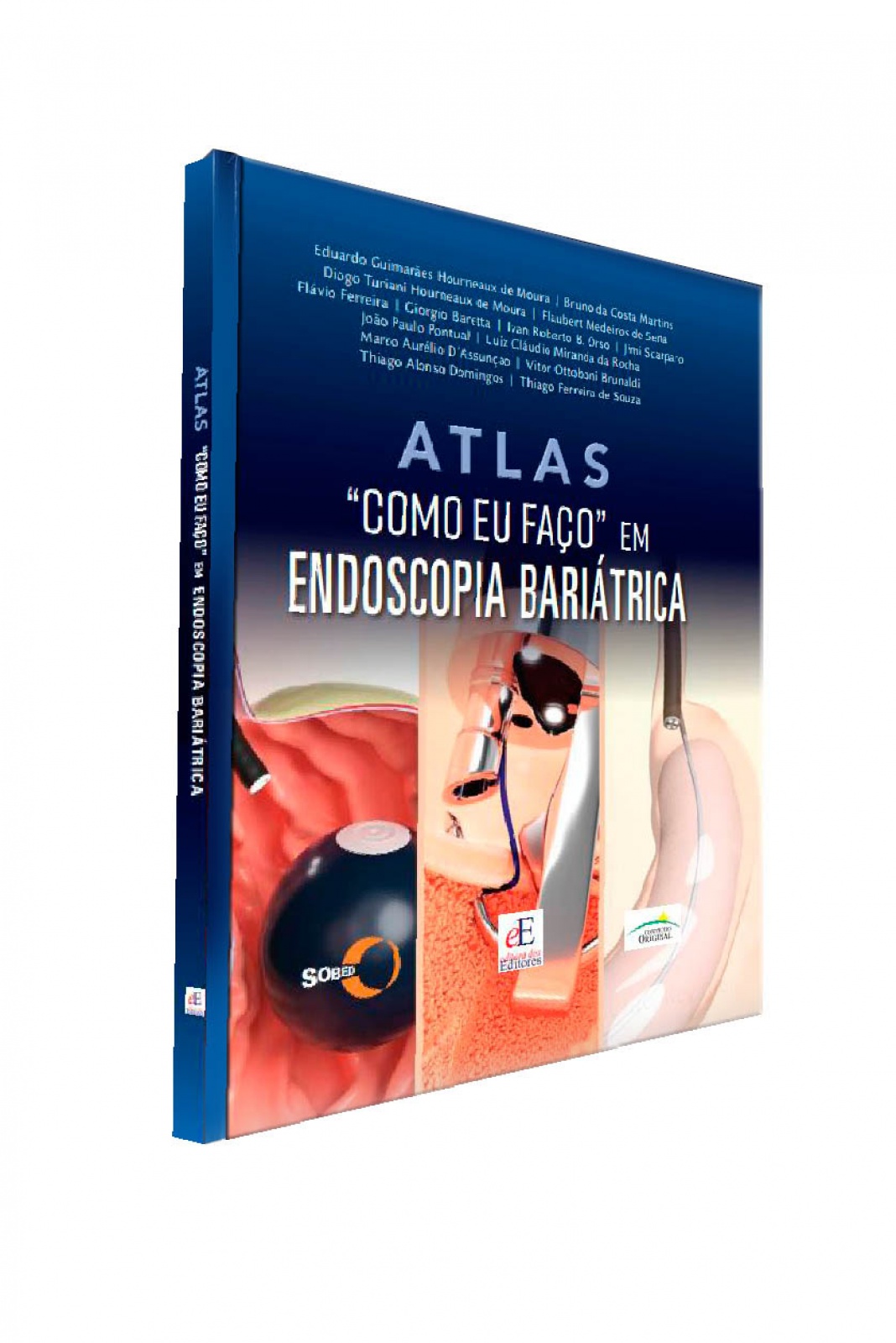 Atlas Como Eu Faço Em Endoscopia Bariátrica