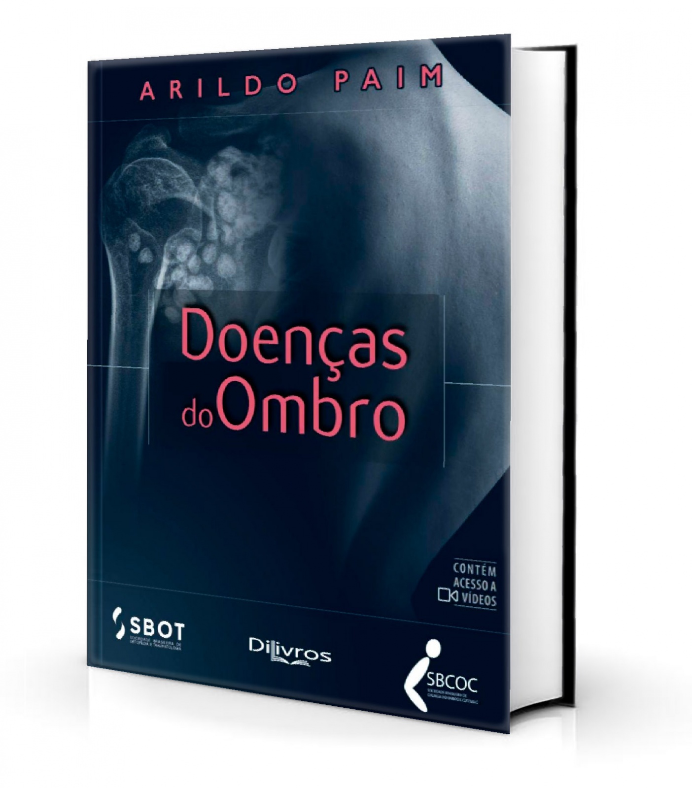 Doenças Do Ombro