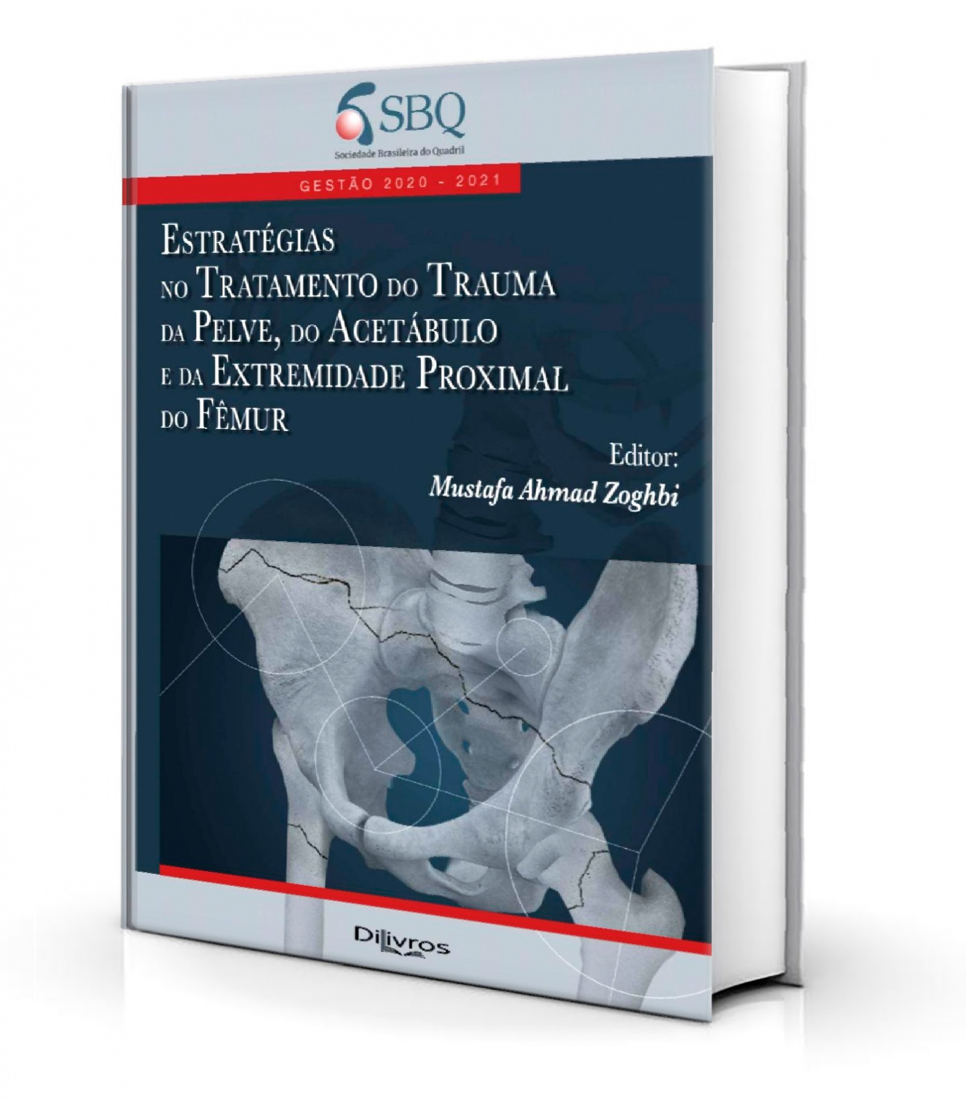  Estratégias No Tratamento Do Trauma Da Pelve, Do Acetábulo E Da Extremidade Proximal Do Fêmur