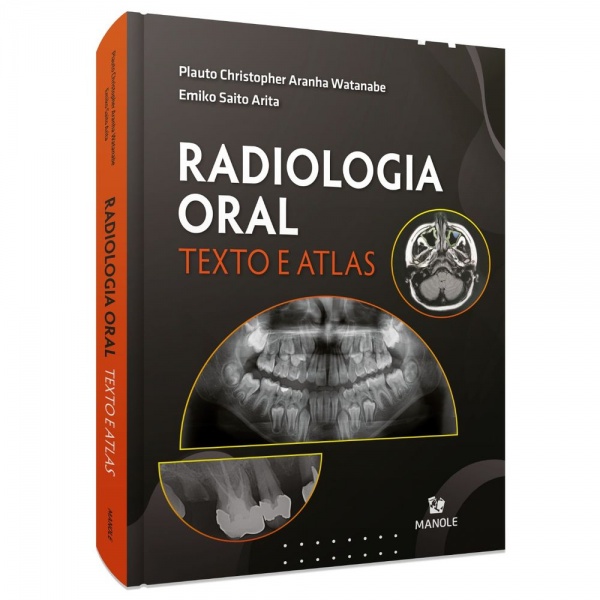 Radiologia Oral - Texto E Atlas