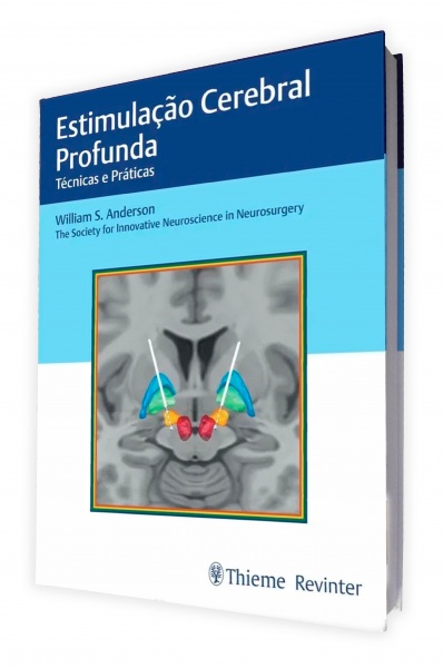 Estimulação Cerebral Profunda - Técnicas E Práticas