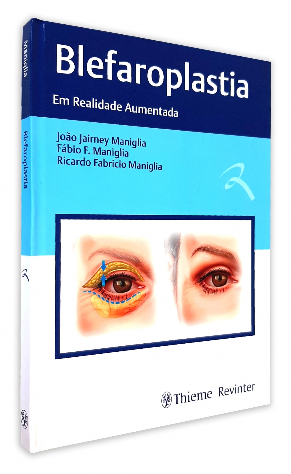 Blefaroplastia Em Realidade Aumentada