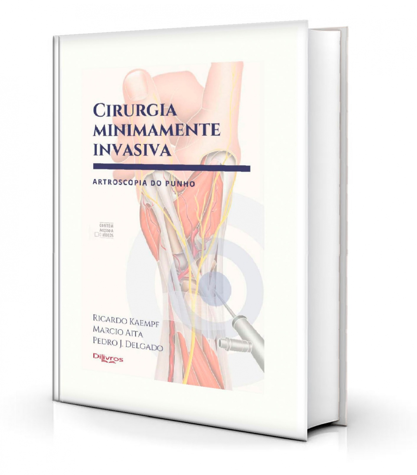 Cirurgia Minimamente Invasiva Artroscopia Do Punho