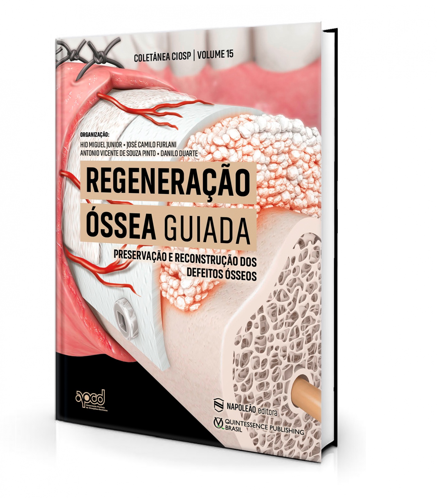 Regeneração Óssea Guiada, Preservação E Reconstrução Dos Defeitos Ósseos - Vol 15