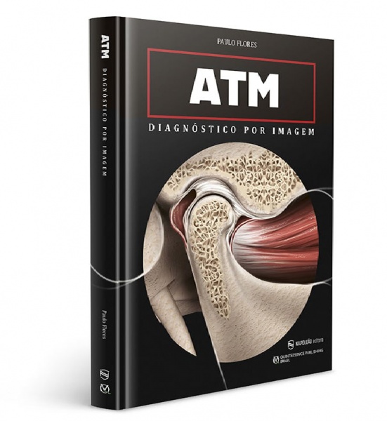 Atm – Diagnóstico Por Imagem