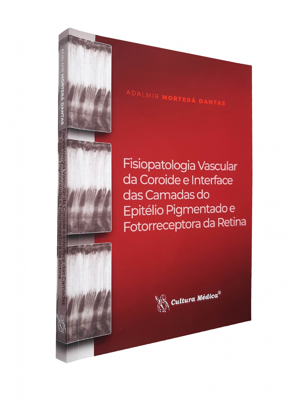 Fisiopatologia Vascular Da Coroide E Interface Das Camadas Do Epitélio Pigmentado E Fotorreceptora Da Retina