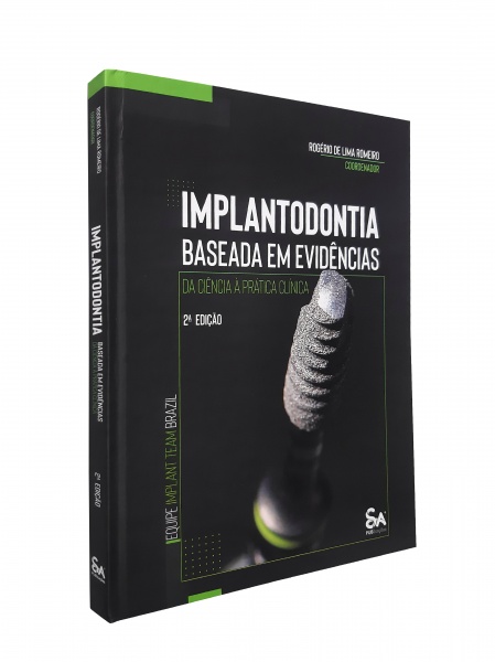 Implantodontia Baseada Em Evidências: Da Ciência À Prática Clínica - Equipe Implant Team Brazil