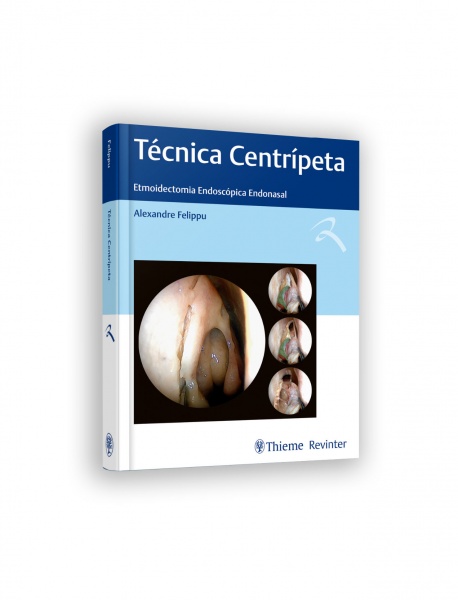 Técnica Centrípeta - Etmoidectomia Endoscópica Endonasal