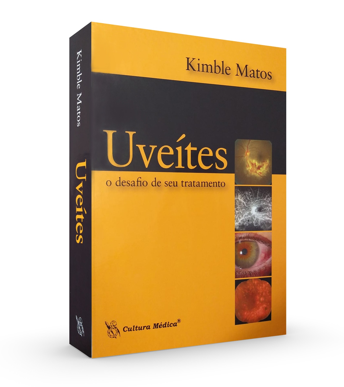 Uveítes - O Desafio De Seu Tratamento