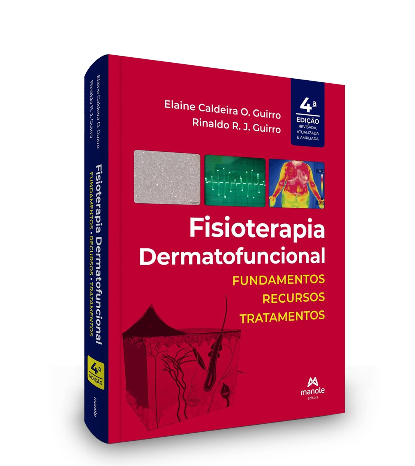 Fisioterapia Dermatofuncional - Fundamentos, Recursos E Tratamentos