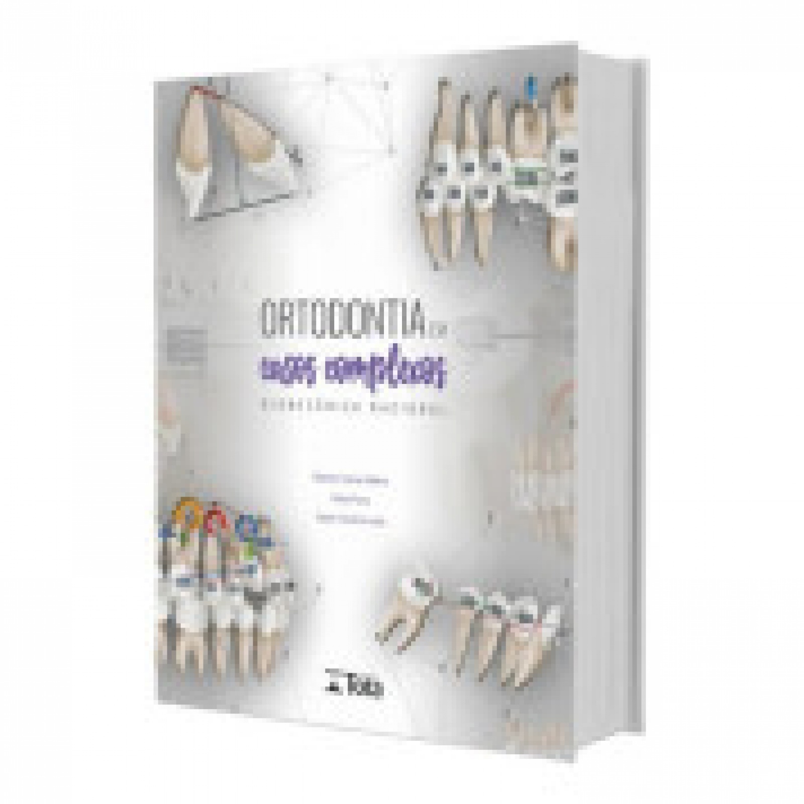Ortodontia Em Casos Complexos - Biomecânica Racional