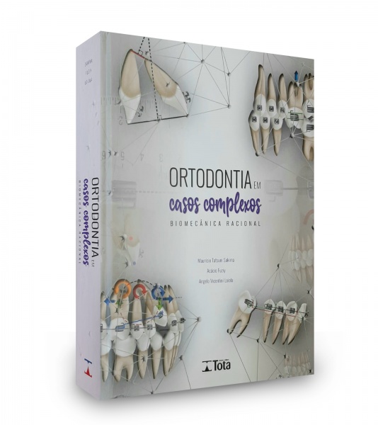 Ortodontia Em Casos Complexos - Biomecânica Racional