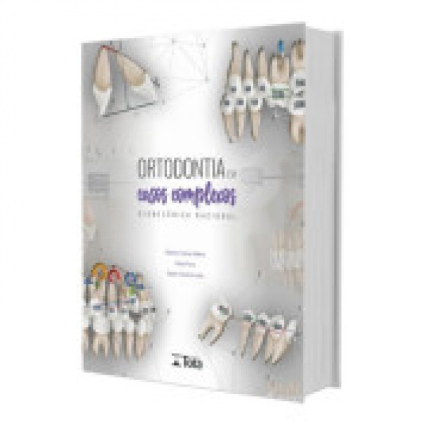 Ortodontia Em Casos Complexos - Biomecânica Racional