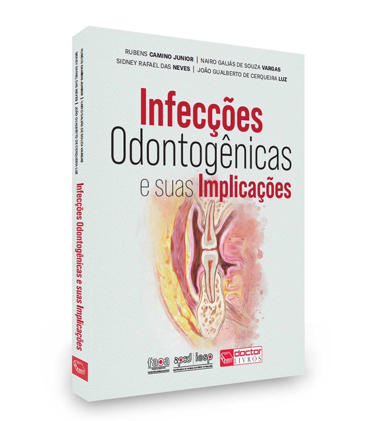 Infecções Odontogênicas E Suas Implicações