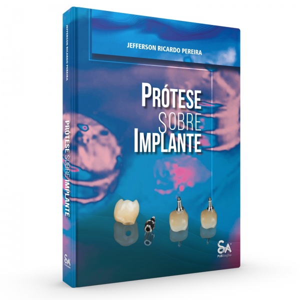 Prótese Sobre Implante