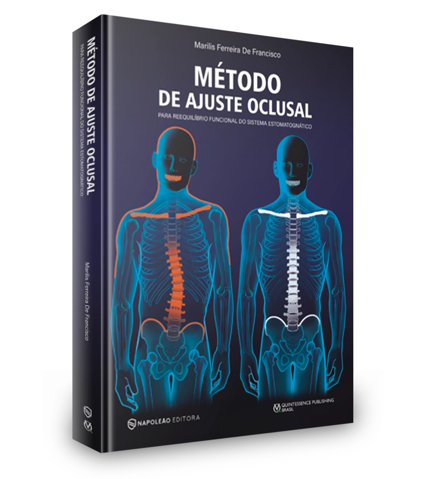 Método De Ajuste Oclusal Para Reequilíbrio Funcional Do Sistema Estomatognático