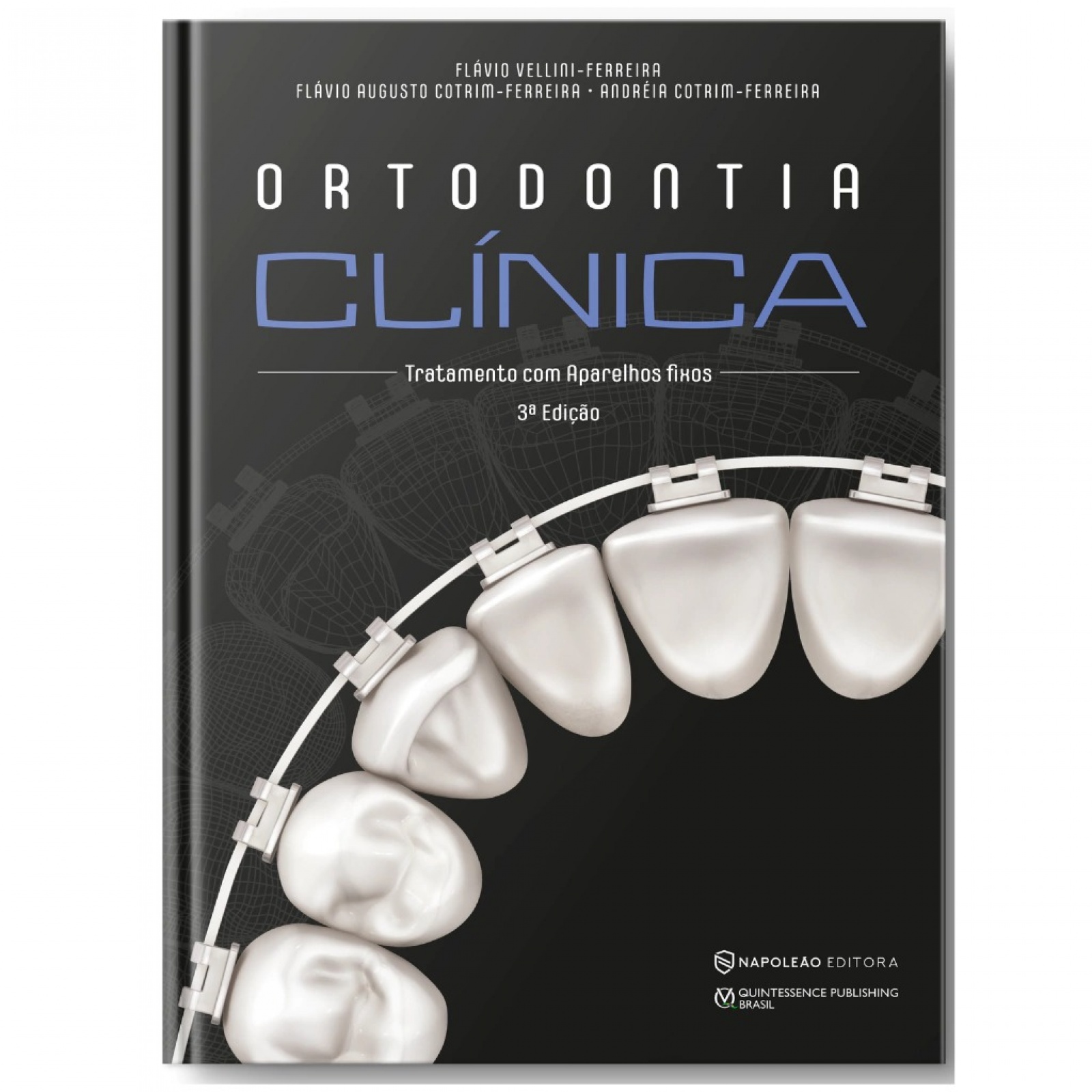 Ortodontia Clínica - Tratamento Com Aparelhos Fixos