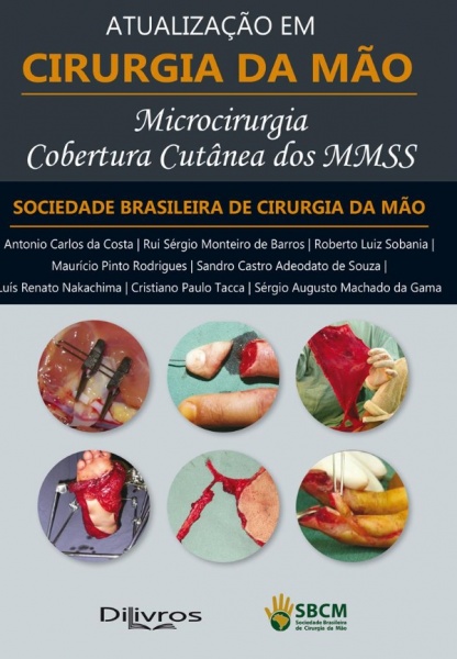 Microcirurgia Cobertura Cutânea Dos Mmss: Atualização Em Cirurgia Da Mão
