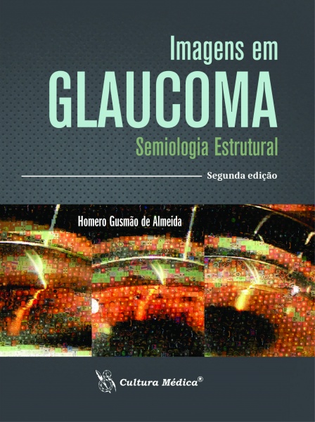 Imagens Em Glaucoma – Semiologia Estrutural