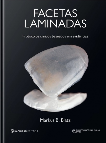 Facetas Laminadas – Protocolos Clínicos Baseados Em Evidências