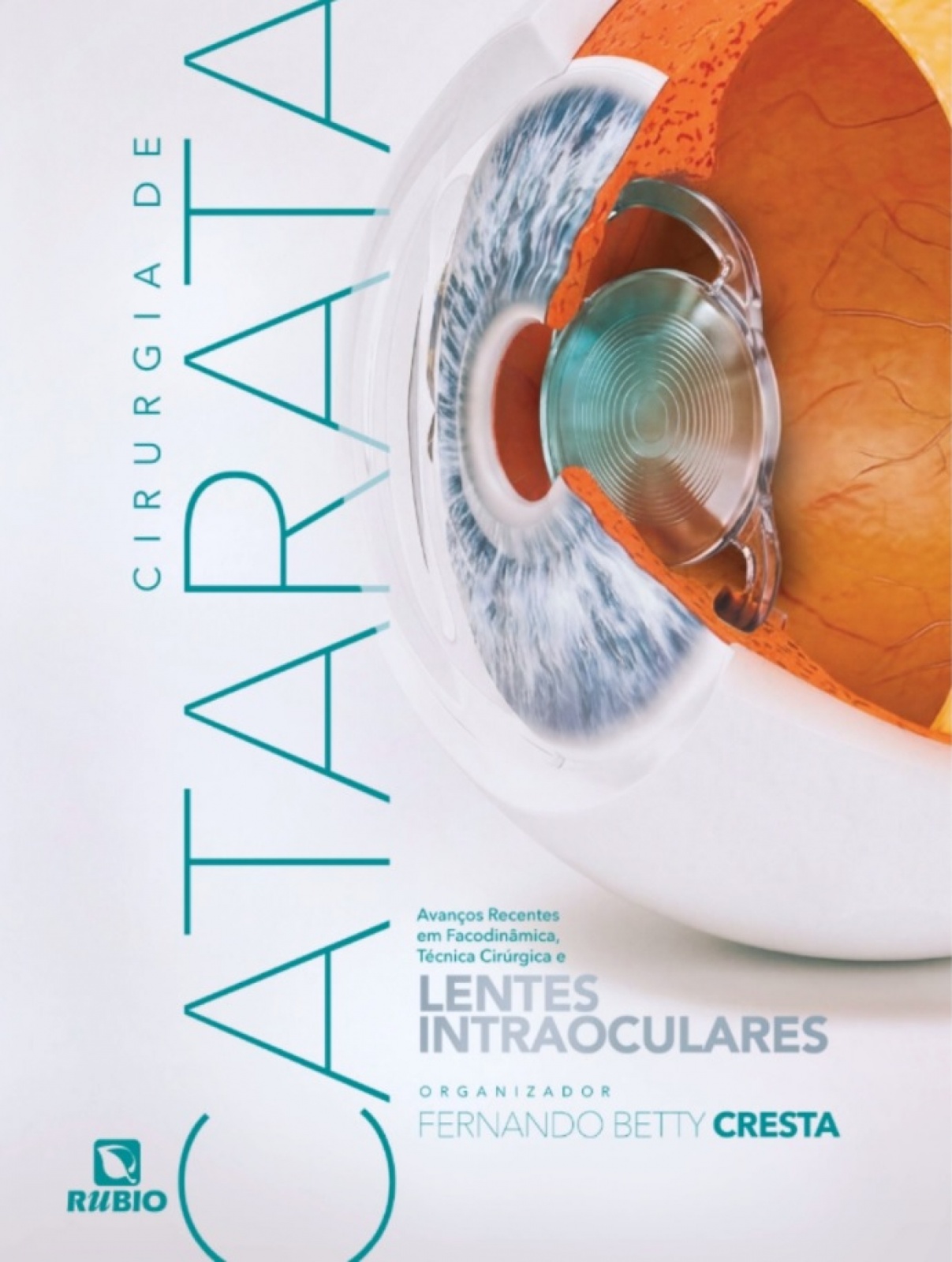 Cirurgia De Catarata Avanços Recentes Em Facodinâmica, Técnica Cirúrgica E Lentes Intraoculares