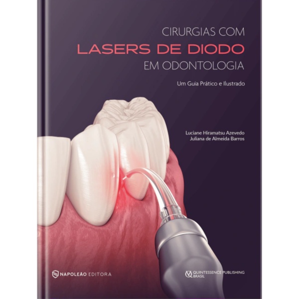 Cirurgias Com Lasers De Diodo Em Odontologia – Um Guia Prático E Ilustrado
